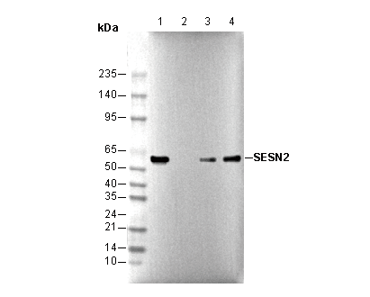 SESN2/Sestrin-2 Antibody