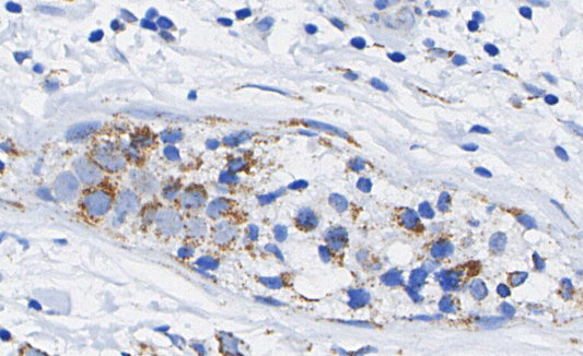 SFRP1 Antibody