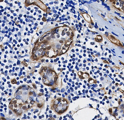 TXNRD1 Antibody