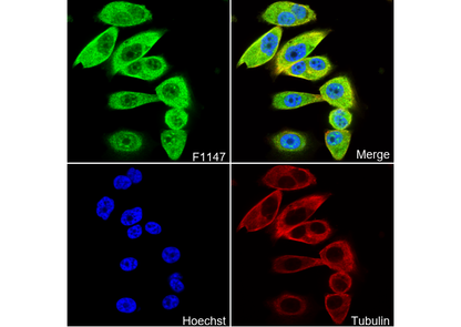 β Arrestin 1 Antibody