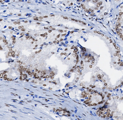 ELK1 Antibody