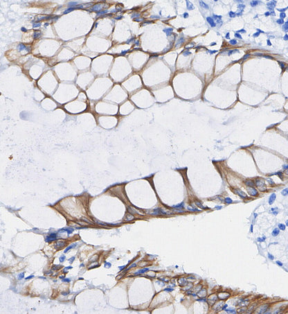 FACL4 Antibody