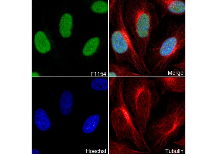 FANCD2 Antibody