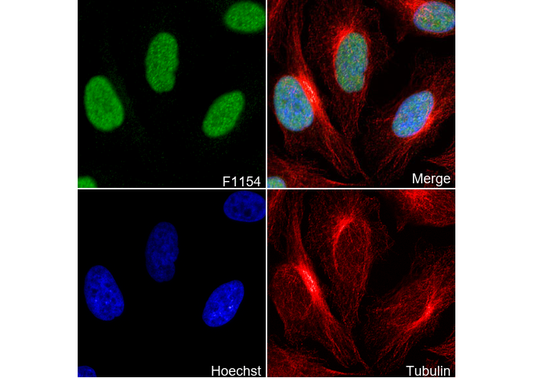 FANCD2 Antibody