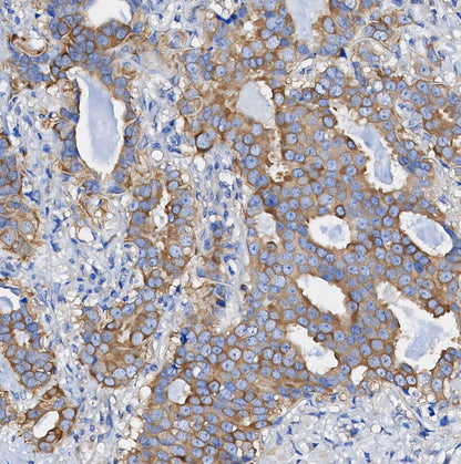 FANCD2 Antibody
