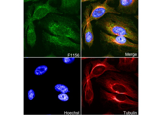 GABARAP+GABARAPL1+GABARAPL2 Antibody