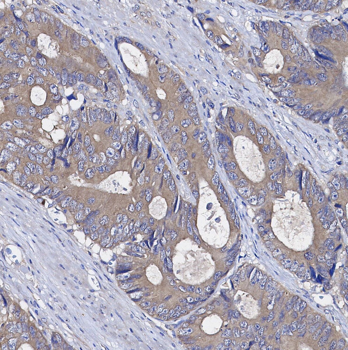 GABARAP+GABARAPL1+GABARAPL2 Antibody