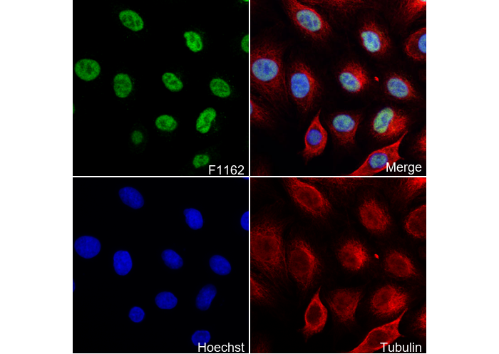 RPA70 Antibody