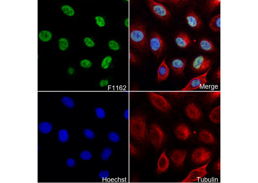 RPA70 Antibody