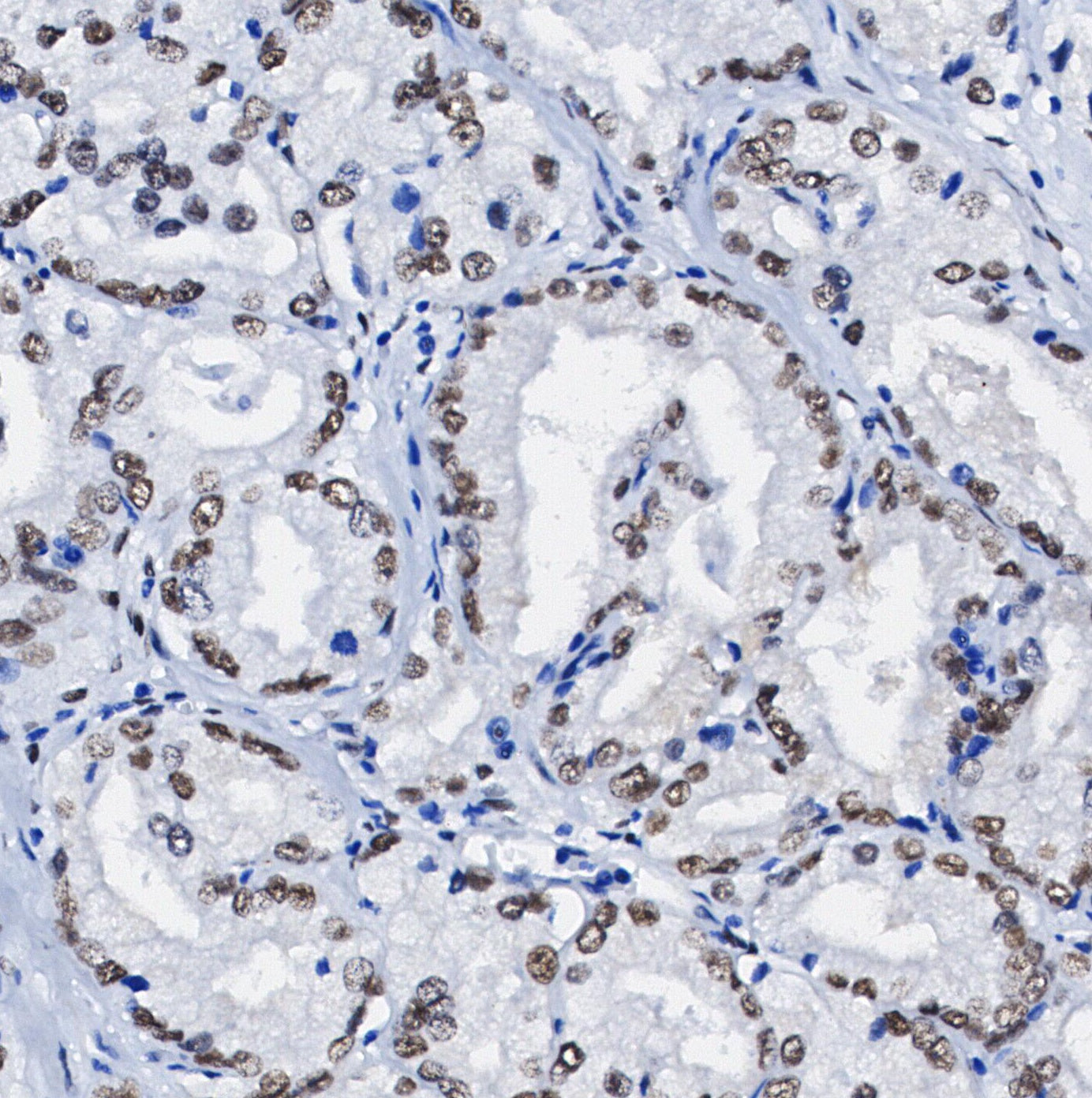 Phospho-p27 KIP 1 (Ser10) Antibody