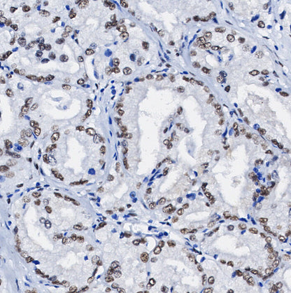 Phospho-p27 KIP 1 (Ser10) Antibody