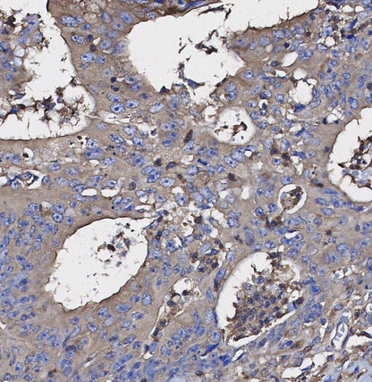 ASK1 Antibody