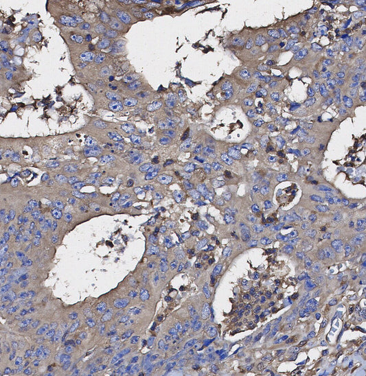 ASK1 Antibody