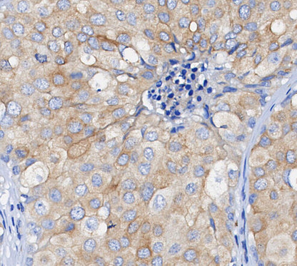 ATG9A Antibody