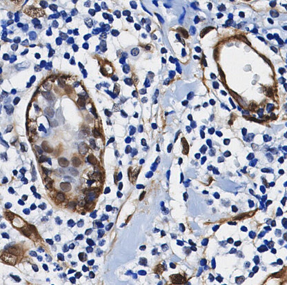ATP citrate lyase Antibody