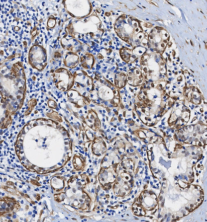 CDKN2A/p16INK4a Antibody