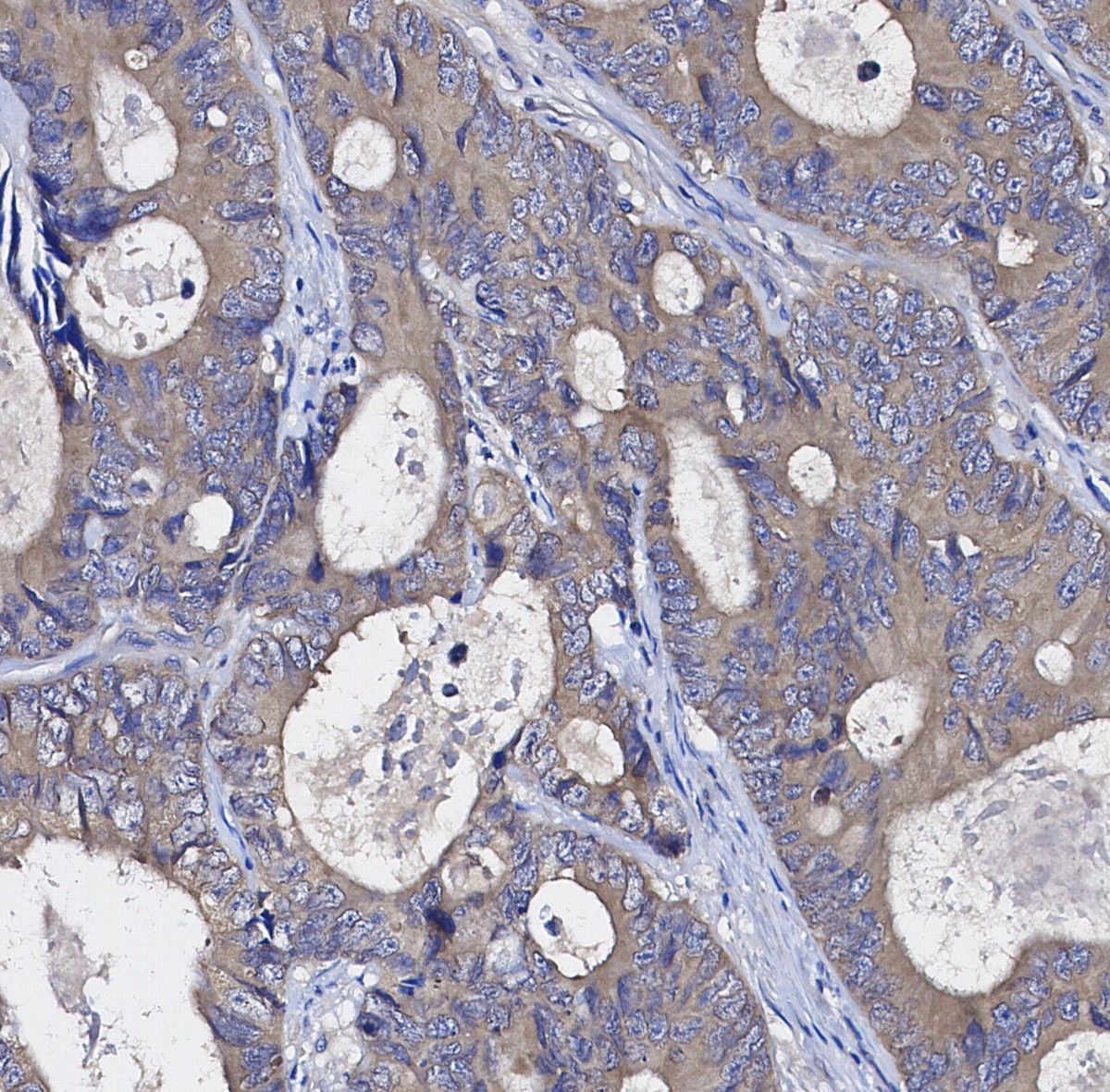 Cytokeratin 20 Antibody