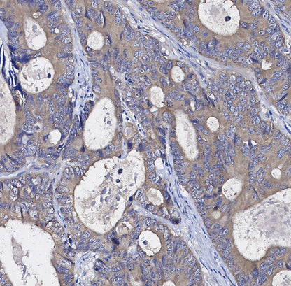 Cytokeratin 20 Antibody