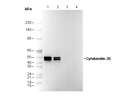 Cytokeratin 20 Antibody