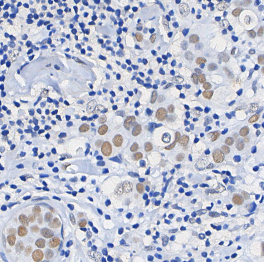 DNA Ligase IV/LIG4 Antibody
