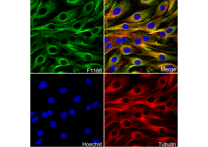 Desmin - Cytoskeleton Marker Antibody