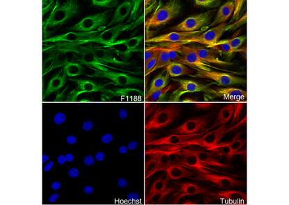 Desmin - Cytoskeleton Marker Antibody