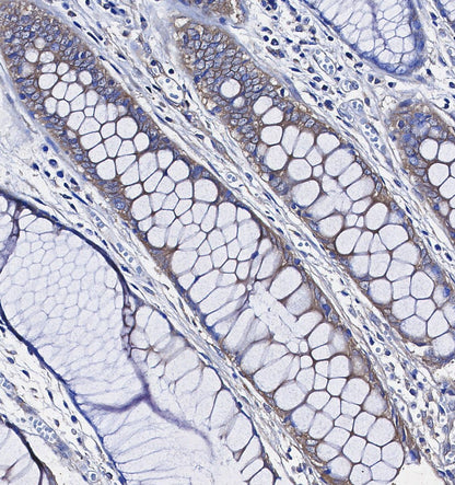 FXR1 Antibody
