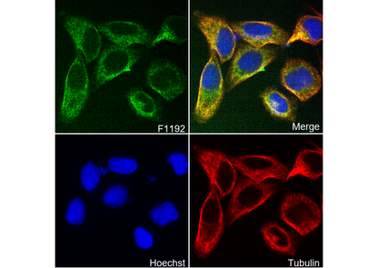 Glucose Transporter GLUT1 Antibody