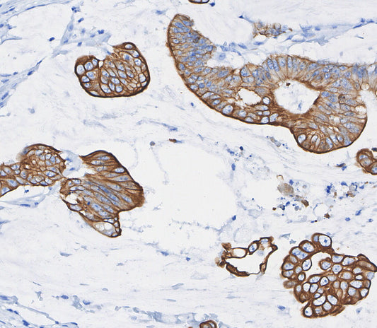 Glucose Transporter GLUT1 Antibody