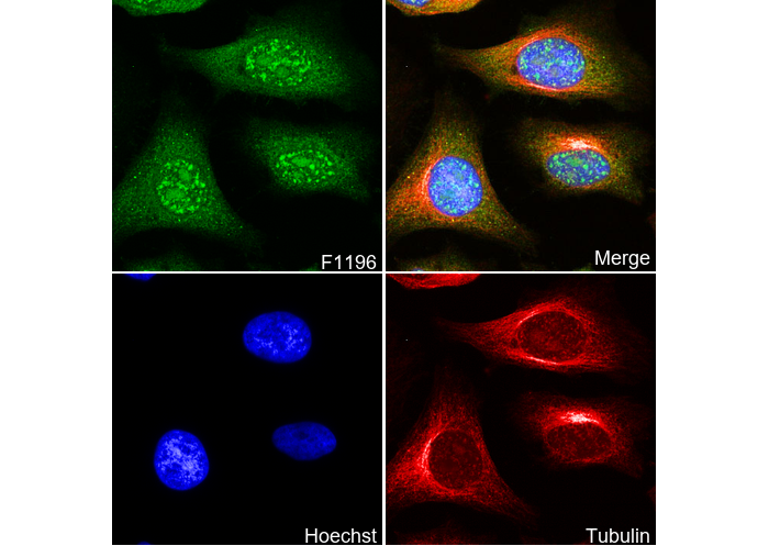IKK γ/NEMO Antibody