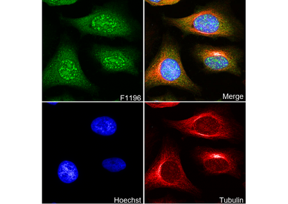 IKK γ/NEMO Antibody