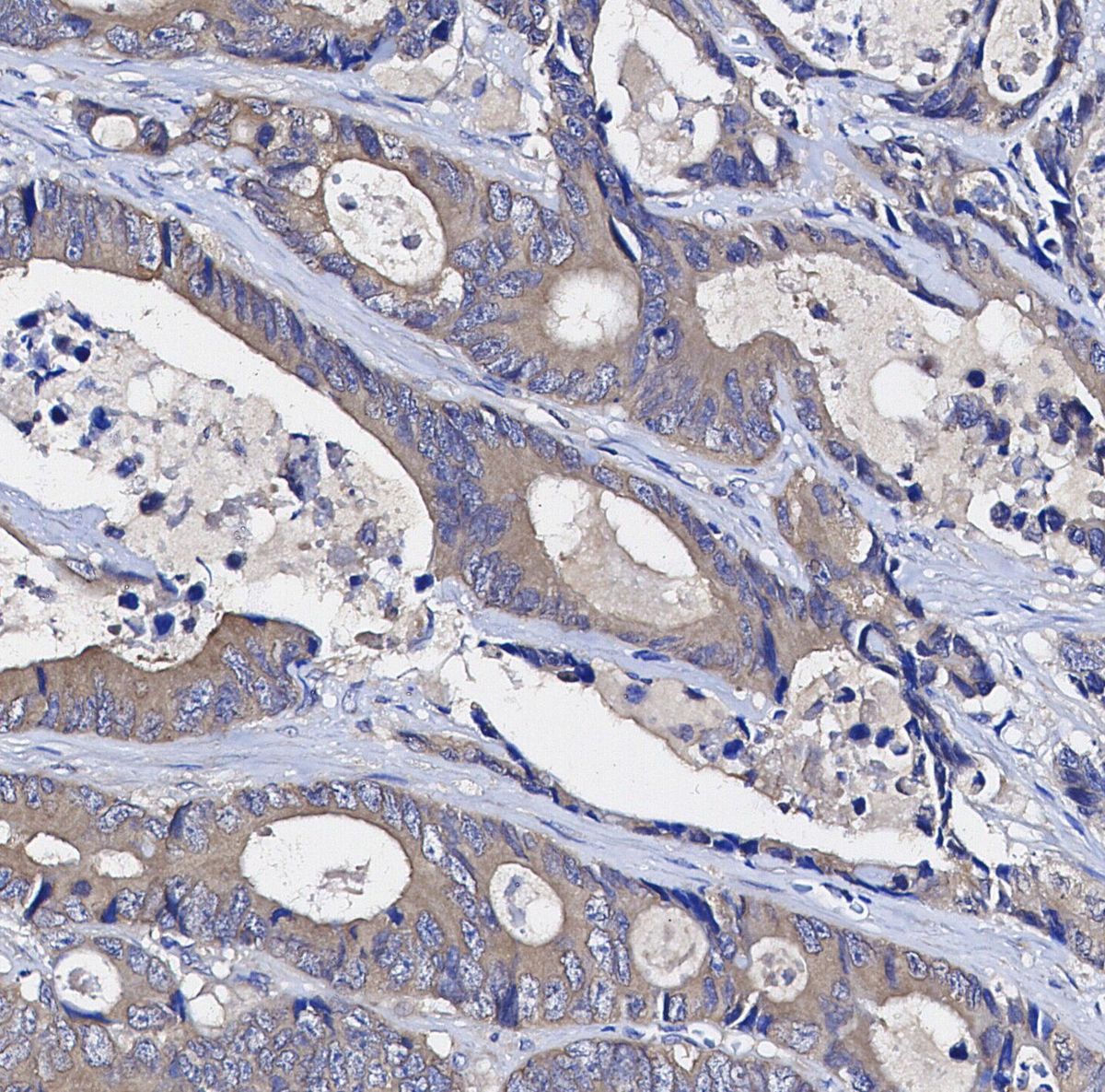 IKK γ/NEMO Antibody