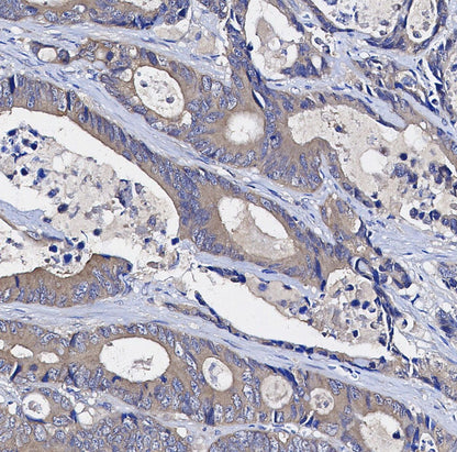IKK γ/NEMO Antibody