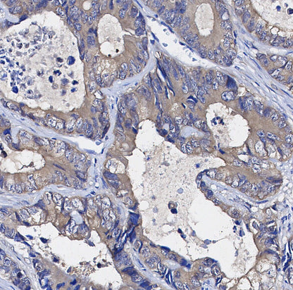 MUC1 Antibody