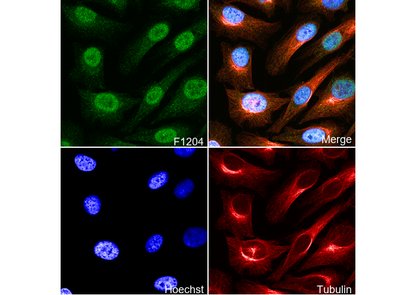 PFKFB3 Antibody