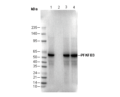 PFKFB3 Antibody