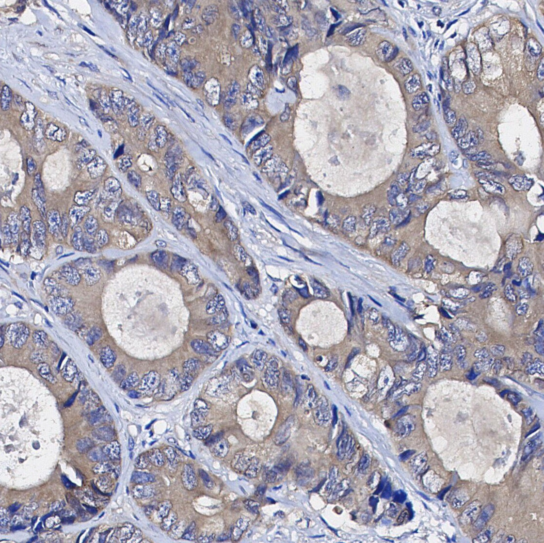 PKR Antibody