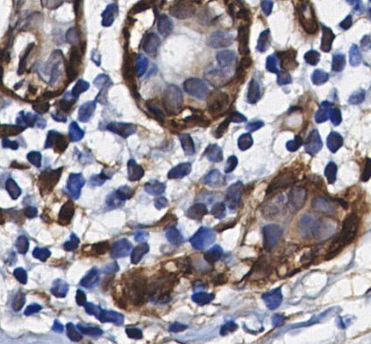 PYK2 Antibody