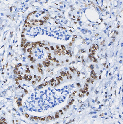 Phospho-STAT3 (Ser727) Antibody