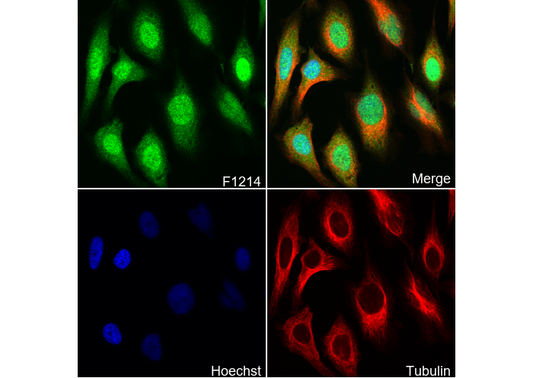 Superoxide Dismutase 1 Antibody