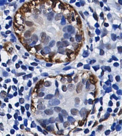 Superoxide Dismutase 1 Antibody