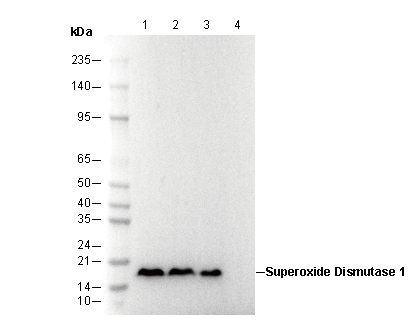 Superoxide Dismutase 1 Antibody