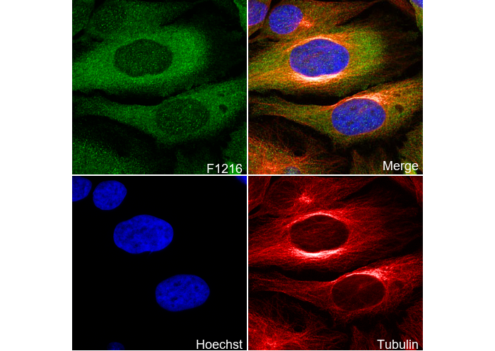TACC3 Antibody
