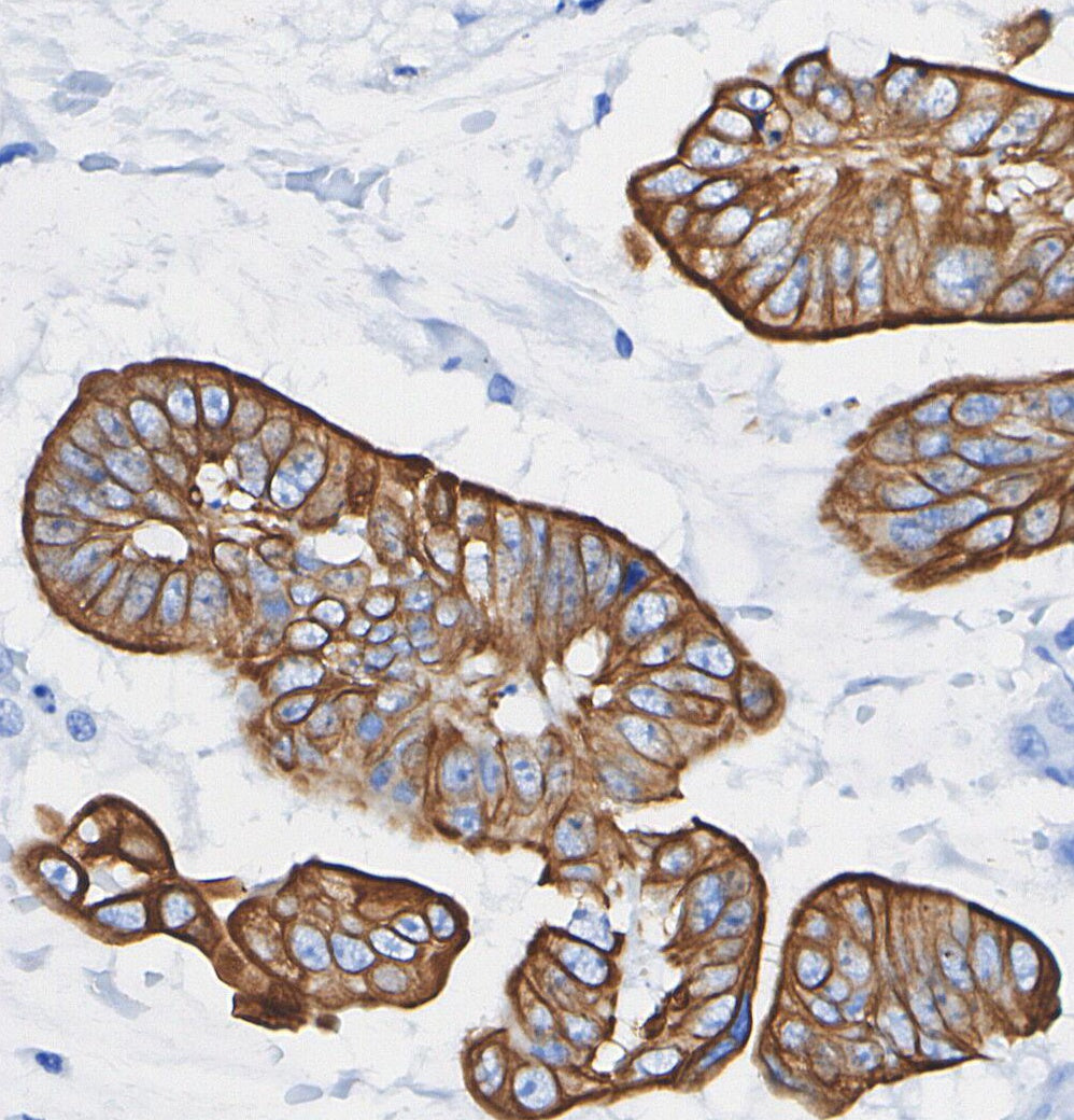 TACC3 Antibody