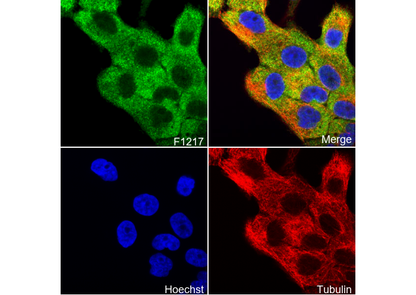 TCTP Antibody