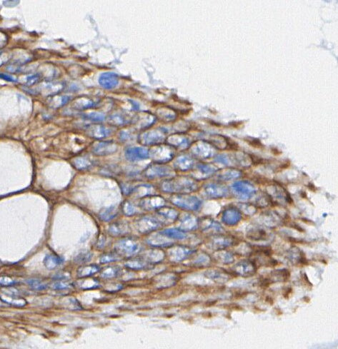 COL1A1 Antibody