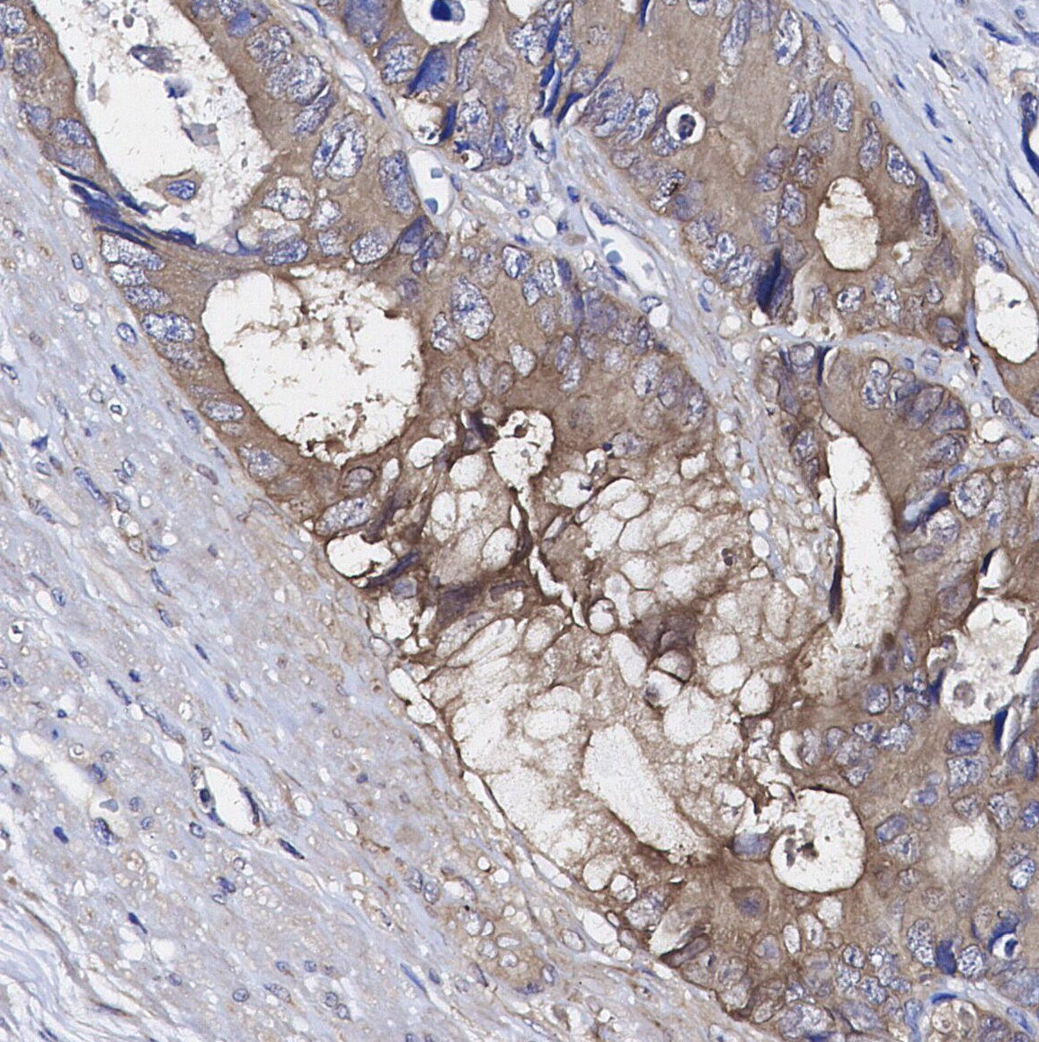 Chronophin/PDXP Antibody