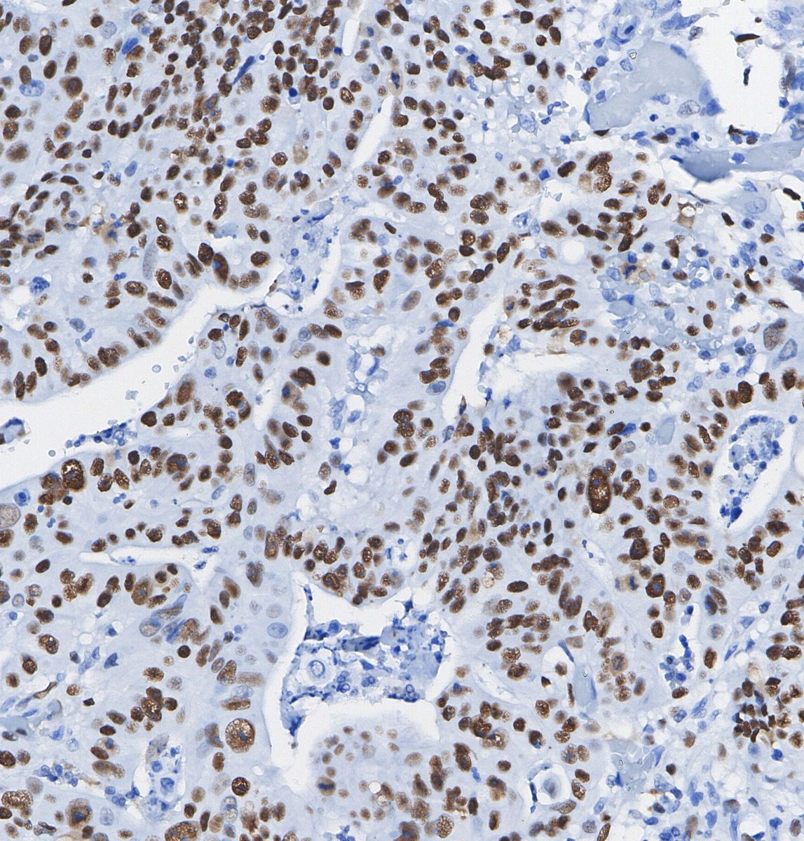 MCM4 Antibody