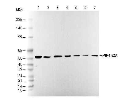 PIP4K2A Antibody