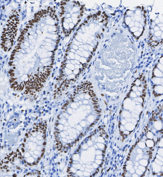 PP2C-α Antibody